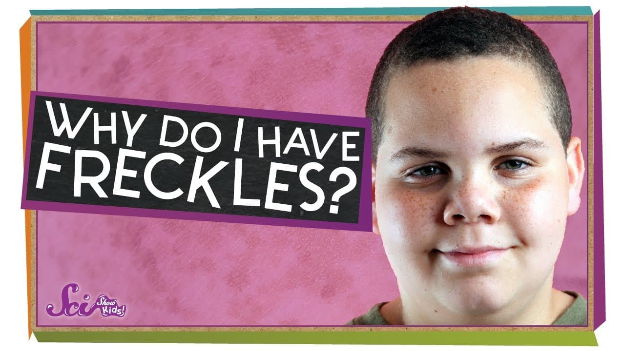 Why We Have Freckles and How They Work