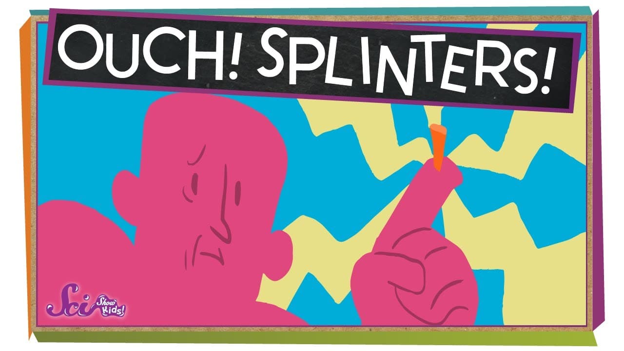 What Is a Splinter and How to Remove It Safely